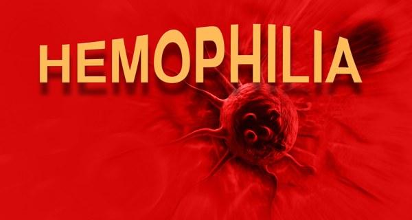 If You Have Frequent Nosebleeds, You May Have Hemophilia: Learn The Risk, Symptoms, And Necessary Treatment For Internal Bleeding To Brain Hemorrhage