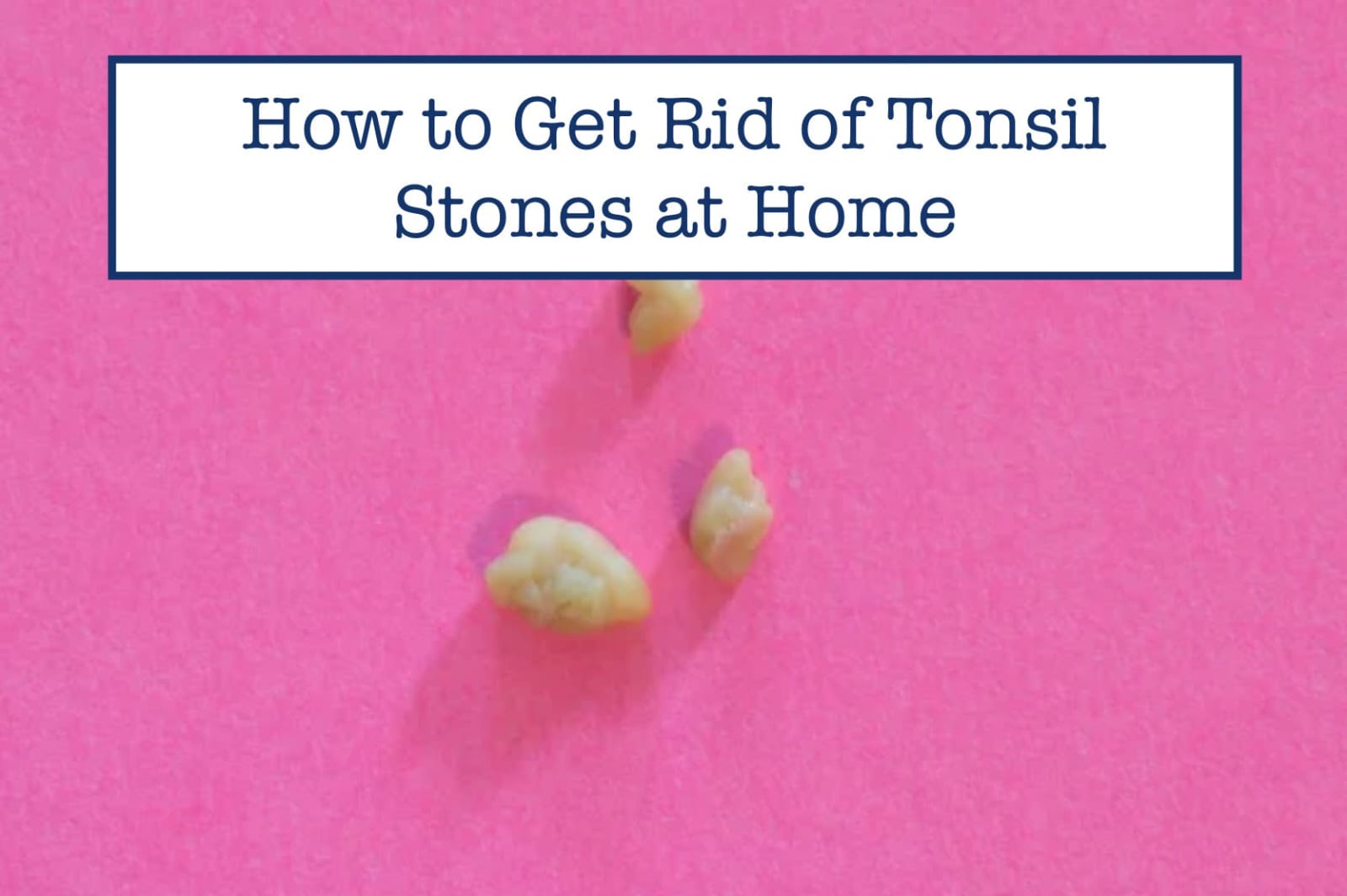 How To Treat Tonsil Stones At Home? Learn From An Ayurvedic Doctor
